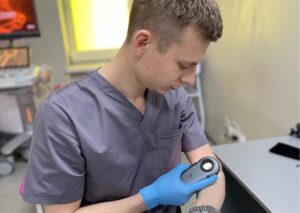 Дерматоскопія родимок у Києві